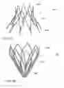 Fig. 16 - Mitral valve inversion prostheses