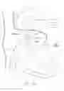 Fig. 22 - Mitral valve inversion prostheses