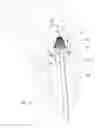 Fig. 04 - Mitral valve inversion prostheses