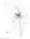Fig. 06 - Mitral valve inversion prostheses