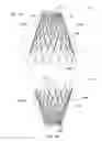 Fig. 11 - Mitral valve inversion prostheses
