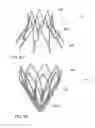 Fig. 16 - Mitral valve inversion prostheses