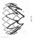 Fig. 19 - Mitral valve inversion prostheses