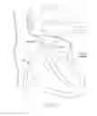 Fig. 22 - Mitral valve inversion prostheses