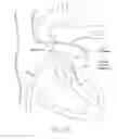 Fig. 23 - Mitral valve inversion prostheses
