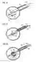 Fig. 14 - Stimulation of penis erection
