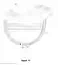 Fig. 09 - Implant surfaces