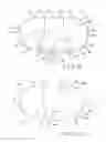 Fig. 05 - ACL accommodating tibial design