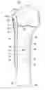 Fig. 01 - Orthopaedic implant and method of installing same