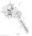 Fig. 02 - Orthopaedic implant and method of installing same
