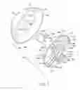 Fig. 04 - Orthopaedic implant and method of installing same