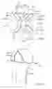 Fig. 06 - Orthopaedic implant and method of installing same