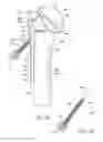 Fig. 07 - Orthopaedic implant and method of installing same