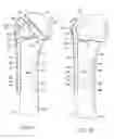 Fig. 08 - Orthopaedic implant and method of installing same