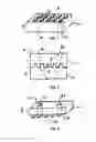 Fig. 03 - Multi-piece intervertebral implants