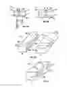 Fig. 08 - Multi-piece intervertebral implants