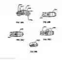 Fig. 19 - Multi-piece intervertebral implants