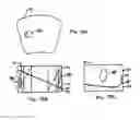 Fig. 34 - Multi-piece intervertebral implants