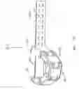 Fig. 10 - Laterally deflectable implant
