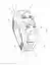 Fig. 02 - Expandable spinal interbody spacer and method of use