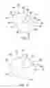 Fig. 03 - Method for spinal adjustment using hinged spinal insert device
