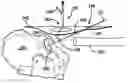 Fig. 01 - Inside-out guide for hip replacement method