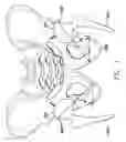 Fig. 02 - Inside-out guide for hip replacement method