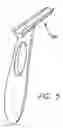 Fig. 05 - Inside-out guide for hip replacement method