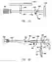 Fig. 16 - Inside-out guide for hip replacement method