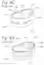 Fig. 06 - Apparatus and method for stabilizing adjacent bone portions