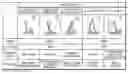 Fig. 01 - Controlling power in a prosthesis or orthosis based on predicted walking speed or surrogate for same