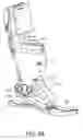 Fig. 08 - Controlling power in a prosthesis or orthosis based on predicted walking speed or surrogate for same
