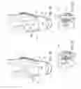 Fig. 10 - Transfemoral prosthetic socket with a textile-based cover and intra-frame force applicators