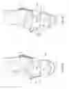 Fig. 11 - Transfemoral prosthetic socket with a textile-based cover and intra-frame force applicators