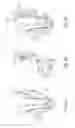 Fig. 14 - Transfemoral prosthetic socket with a textile-based cover and intra-frame force applicators