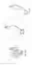 Fig. 18 - Transfemoral prosthetic socket with a textile-based cover and intra-frame force applicators