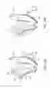 Fig. 20 - Transfemoral prosthetic socket with a textile-based cover and intra-frame force applicators