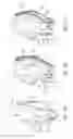 Fig. 21 - Transfemoral prosthetic socket with a textile-based cover and intra-frame force applicators