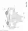 Fig. 29 - Transfemoral prosthetic socket with a textile-based cover and intra-frame force applicators
