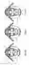 Fig. 08 - Transtibial prosthetic socket with textile jacket