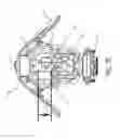 Fig. 19 - Transtibial prosthetic socket with textile jacket