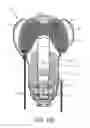 Fig. 28 - Transtibial prosthetic socket with textile jacket
