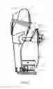 Fig. 31 - Transtibial prosthetic socket with textile jacket
