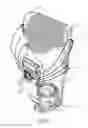 Fig. 32 - Transtibial prosthetic socket with textile jacket