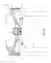 Fig. 33 - Transtibial prosthetic socket with textile jacket