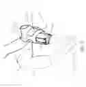 Fig. 35 - Transtibial prosthetic socket with textile jacket