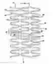 Fig. 01 - INTRAVASCULAR STENT