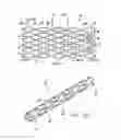 Fig. 03 - INTRAVASCULAR STENT