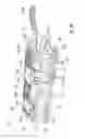 Fig. 15 - Universal wrist brace with enhanced lacing