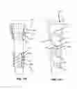Fig. 20 - Adjustable brace assembly and methods of use